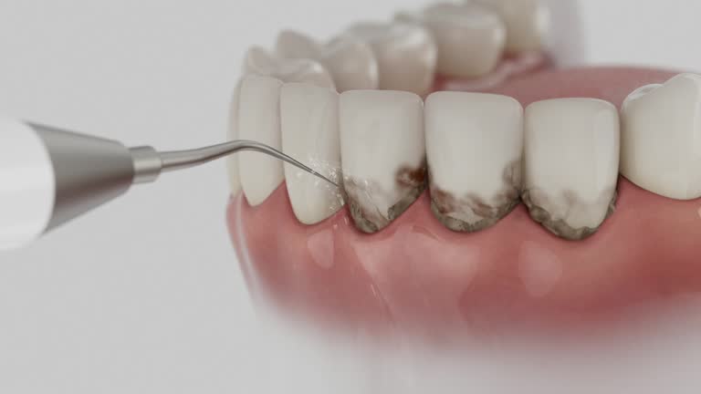 Reliable Dental contractor in Holliday, TX by Dentist Open Now